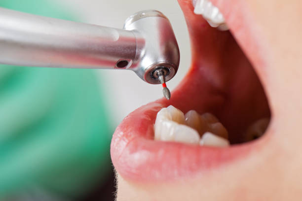 Best Emergency Dental Surgery in Crosbyton, TX